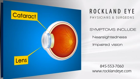 Cataract surgery marketing video
